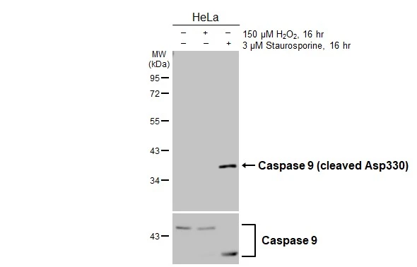 Untreated (–) and treated (+) HeLa whole cell extracts (30 μg) were separated by 10% SDS-PAGE, and the membrane was blotted with Caspase 9 (cleaved Asp330) antibody (GTX132331) diluted at 1:500. The HRP-conjugated anti-rabbit IgG antibody (GTX213110-01) was used to detect the primary antibody, and the signal was developed with Trident ECL plus-Enhanced. Untreated (–) and treated (+) HeLa whole cell extracts (30 μg) were separated by 10% SDS-PAGE, and the membrane was blotted with Caspase 9 (cleaved Asp330) antibody (GTX132331) diluted at 1:500. The HRP-conjugated anti-rabbit IgG antibody (GTX213110-01) was used to detect the primary antibody, and the signal was developed with Trident ECL plus-Enhanced.
