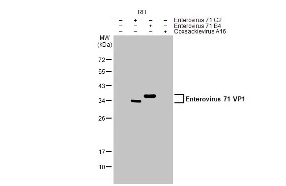 Anti-Enterovirus 71 VP1 antibody (GTX132339) | GeneTex