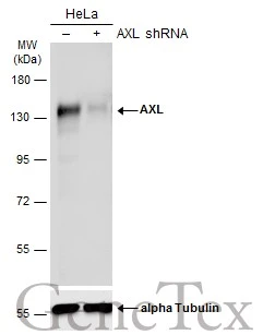 Non-transfected (–) and transfected (+) HeLa whole cell extracts (60 μg) were separated by 7.5% SDS-PAGE, and the membrane was blotted with AXL antibody (GTX132387) diluted at 1:500. The HRP-conjugated anti-rabbit IgG antibody (GTX213110-01) was used to detect the primary antibody.