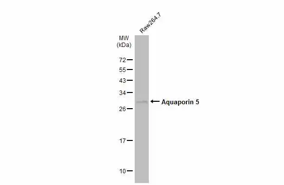 Whole cell extract (30 μg) was separated by 12% SDS-PAGE, and the membrane was blotted with Aquaporin 5 antibody (GTX132400) diluted at 1:1000. The HRP-conjugated anti-rabbit IgG antibody (GTX213110-01) was used to detect the primary antibody, and the signal was developed with Trident ECL plus-Enhanced.