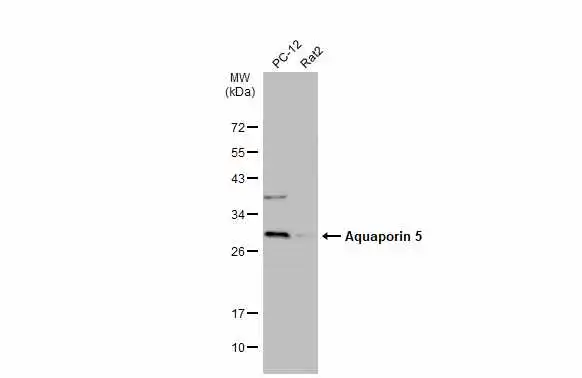 Various whole cell extracts (30 μg) were separated by 12% SDS-PAGE, and the membrane was blotted with Aquaporin 5 antibody (GTX132400) diluted at 1:1000. The HRP-conjugated anti-rabbit IgG antibody (GTX213110-01) was used to detect the primary antibody.
