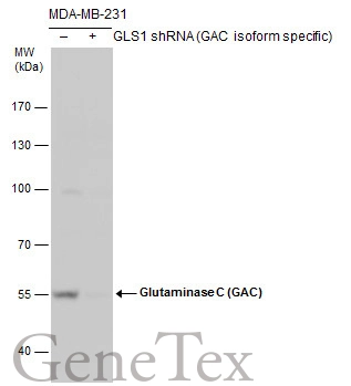 Glutaminase antibody validation by shRNA knock-down. Non-transfected (-) and GLS1(GAC isoform specific) shRNA-transfected MDA-MB-231 whole cell extracts (30 μg) were separated by 7.5% SDS-PAGE, and the membrane was blotted with Glutaminase antibody (GTX132402) diluted by 1:5000.