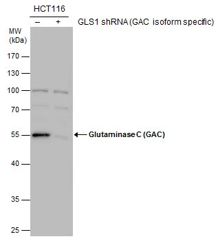 Glutaminase C (GAC) antibody validation by shRNA knock-down. Non-transfected (-) and GLS1(GAC isoform specific) shRNA-transfected HCT116 whole cell extracts (30 μg) were separated by 10% SDS-PAGE, and the membrane was blotted with Glutaminase C (GAC) antibody (GTX132402) at a dilution of 1:5000.