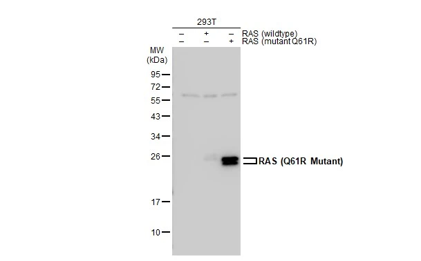 Non-transfected (–) and transfected (+) 293T whole cell extracts (30 μg) were separated by 12% SDS-PAGE, and the membrane was blotted with RAS (Q61R Mutant Specific) antibody (GTX132406) diluted at 1:5000. The HRP-conjugated anti-rabbit IgG antibody (GTX213110-01) was used to detect the primary antibody.