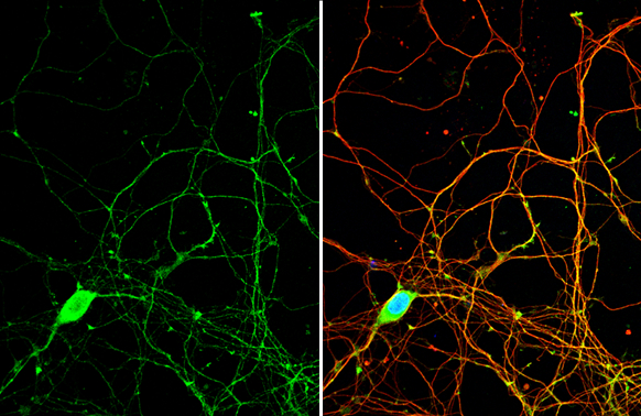 PYK2 antibody detects PYK2 protein by immunofluorescent analysis. Sample: DIV9 rat E18 primary hippocampal neuron cells were fixed in 4% paraformaldehyde at RT for 15 min. Green: PYK2 stained by PYK2 antibody (GTX132447) diluted at 1:500. Red: beta Tubulin 3/ Tuj1, stained by beta Tubulin 3/ Tuj1 antibody [GT11710] (GTX631836) diluted at 1:500. Blue: Fluoroshield with DAPI (GTX30920).
