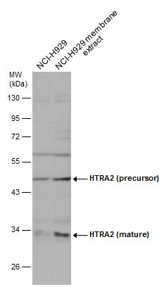 NCI-H929 whole cell and membrane extracts (30 μg) were separated by 10% SDS-PAGE, and the membrane was blotted with HTRA2 antibody (GTX132456) diluted at 1:500.