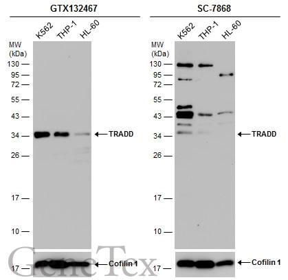 Various whole cell extracts (30 μg) were separated by 12% SDS-PAGE, and the membranes were blotted with TRADD antibody (GTX132467) diluted at 1:1000 and competitor's antibody (SC-7868) diluted by 1:200.