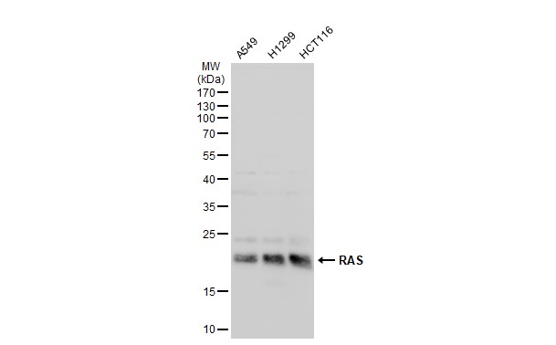 Ras antibody [N1N3] detects Ras protein by western blot analysis. Various whole cell extracts (30 ug) were separated by 15% SDS-PAGE,and the membrane was blotted with Ras antibody [N1N3] (GTX132480) diluted at a dilution of 1:1000.