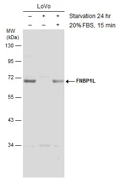 Untreated (–) and treated (+) LoVo whole cell extracts (60 μg) were separated by 10% SDS-PAGE, and the membrane was blotted with FNBP1L antibody (GTX132527) diluted at 1:1000.