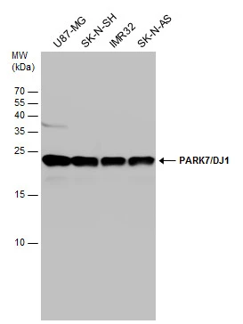 Various whole cell extracts (30 μg) were separated by 15% SDS-PAGE, and the membrane was blotted with PARK7/DJ1 antibody (GTX132552) diluted at 1:1000. Various whole cell extracts (30 μg) were separated by 15% SDS-PAGE, and the membrane was blotted with PARK7/DJ1 antibody (GTX132552) diluted at 1:1000.