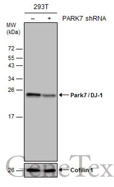 Non-transfected (–) and transfected (+) 293T whole cell extracts (30 μg) were separated by 15% SDS-PAGE, and the membrane was blotted with Park7 / DJ-1 antibody (GTX132552) diluted at 1:20000. Non-transfected (–) and transfected (+) 293T whole cell extracts (30 μg) were separated by 15% SDS-PAGE, and the membrane was blotted with Park7 / DJ-1 antibody (GTX132552) diluted at 1:20000.