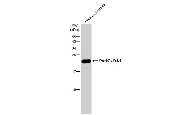 Mouse tissue extract (50 μg) was separated by 15% SDS-PAGE, and the membrane was blotted with Park7 / DJ-1 antibody (GTX132552) diluted at 1:1000. The HRP-conjugated anti-rabbit IgG antibody (GTX213110-01) was used to detect the primary antibody.