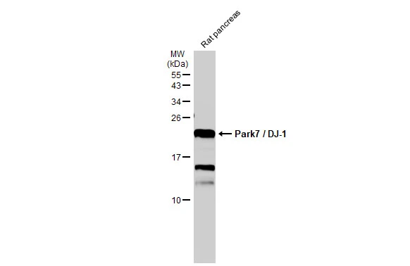 Rat tissue extract (50 μg) was separated by 15% SDS-PAGE, and the membrane was blotted with Park7 / DJ-1 antibody (GTX132552) diluted at 1:1000. The HRP-conjugated anti-rabbit IgG antibody (GTX213110-01) was used to detect the primary antibody. Rat tissue extract (50 μg) was separated by 15% SDS-PAGE, and the membrane was blotted with Park7 / DJ-1 antibody (GTX132552) diluted at 1:1000. The HRP-conjugated anti-rabbit IgG antibody (GTX213110-01) was used to detect the primary antibody.
