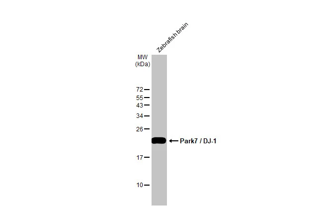 Zebrafish tissue extract (30 μg) was separated by 15% SDS-PAGE, and the membrane was blotted with Park7 / DJ-1 antibody (GTX132552) diluted at 1:1000. The HRP-conjugated anti-rabbit IgG antibody (GTX213110-01) was used to detect the primary antibody. Zebrafish tissue extract (30 μg) was separated by 15% SDS-PAGE, and the membrane was blotted with Park7 / DJ-1 antibody (GTX132552) diluted at 1:1000. The HRP-conjugated anti-rabbit IgG antibody (GTX213110-01) was used to detect the primary antibody.