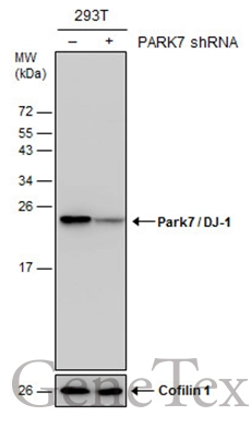 Non-transfected (–) and transfected (+) 293T whole cell extracts (30 μg) were separated by 15% SDS-PAGE, and the membrane was blotted with Park7 / DJ-1 antibody (GTX132556) diluted at 1:500. Non-transfected (–) and transfected (+) 293T whole cell extracts (30 μg) were separated by 15% SDS-PAGE, and the membrane was blotted with Park7 / DJ-1 antibody (GTX132556) diluted at 1:500.