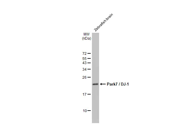 Zebrafish tissue extract (30 μg) was separated by 15% SDS-PAGE, and the membrane was blotted with Park7 / DJ-1 antibody (GTX132556) diluted at 1:1000. The HRP-conjugated anti-rabbit IgG antibody (GTX213110-01) was used to detect the primary antibody. Zebrafish tissue extract (30 μg) was separated by 15% SDS-PAGE, and the membrane was blotted with Park7 / DJ-1 antibody (GTX132556) diluted at 1:1000. The HRP-conjugated anti-rabbit IgG antibody (GTX213110-01) was used to detect the primary antibody.
