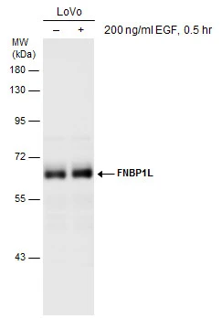 Untreated (–) and treated (+) LoVo whole cell extracts (60 μg) were separated by 10% SDS-PAGE, and the membrane was blotted with FNBP1L antibody (GTX132563) diluted at 1:1000.