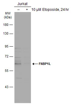 Untreated (–) and treated (+) Jurkat whole cell extracts (30 μg) were separated by 7.5% SDS-PAGE, and the membrane was blotted with FNBP1L antibody (GTX132563) diluted at 1:1000. The HRP-conjugated anti-rabbit IgG antibody (GTX213110-01) was used to detect the primary antibody.