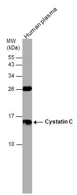 Human tissue extract (30 μg) was separated by 15% SDS-PAGE, and the membrane was blotted with Cystatin C antibody (GTX132567) diluted at 1:1000. Human tissue extract (30 μg) was separated by 15% SDS-PAGE, and the membrane was blotted with Cystatin C antibody (GTX132567) diluted at 1:1000.