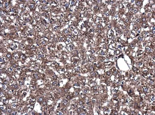 Park7/DJ-1 antibody detects Park7/DJ-1 protein at cytoplasm in rat liver by immunohistochemical analysis. Sample: Paraffin-embedded rat liver. Park7/DJ-1 antibody (GTX132574) diluted at 1:500. 
 Antigen Retrieval: Citrate buffer, pH 6.0, 15 min