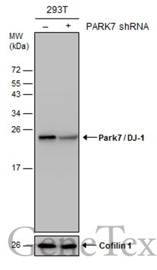 Non-transfected (–) and transfected (+) 293T whole cell extracts (30 μg) were separated by 15% SDS-PAGE, and the membrane was blotted with Park7 / DJ-1 antibody (GTX132574) diluted at 1:20000.