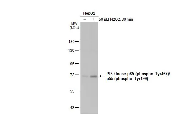 Untreated (–) and treated (+) HepG2 whole cell extracts (30 μg) were separated by 7.5% SDS-PAGE, and the membrane was blotted with PI3 kinase p85 (phospho Tyr467)/p55 (phospho Tyr199) antibody (GTX132597) diluted at 1:500. The HRP-conjugated anti-rabbit IgG antibody (GTX213110-01) was used to detect the primary antibody.