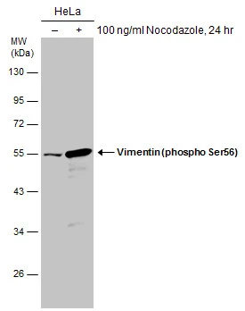 Untreated (–) and treated (+) HeLa whole cell extracts (30 μg) were separated by 10% SDS-PAGE, and the membrane was blotted with Vimentin (phospho Ser56) antibody (GTX132607) diluted at 1:1000.