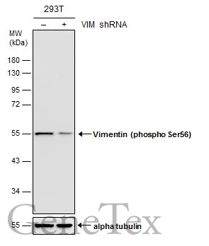 Non-transfected (–) and transfected (+) 293T whole cell extracts (30 μg) were separated by 10% SDS-PAGE, and the membrane was blotted with Vimentin (phospho Ser56) antibody (GTX132607) diluted at 1:5000.