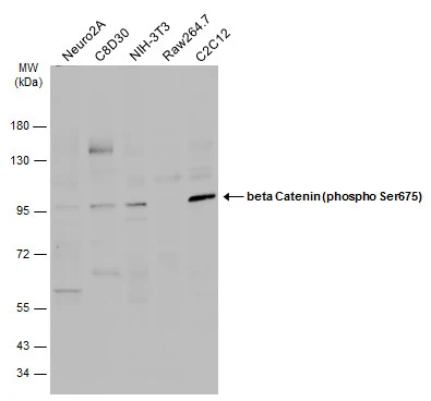 Various whole cell extracts (30 μg) were separated by 7.5% SDS-PAGE, and the membrane was blotted with beta Catenin (phospho Ser675) antibody (GTX132611) diluted at 1:500. The HRP-conjugated anti-rabbit IgG antibody (GTX213110-01) was used to detect the primary antibody.