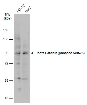 Various whole cell extracts (30 μg) were separated by 7.5% SDS-PAGE, and the membrane was blotted with beta Catenin (phospho Ser675) antibody (GTX132611) diluted at 1:500. The HRP-conjugated anti-rabbit IgG antibody (GTX213110-01) was used to detect the primary antibody.