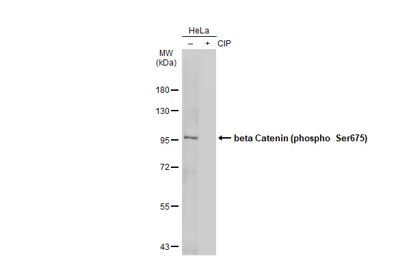 Untreated (–) and treated (+) HeLa whole cell extracts (30 μg) were separated by 7.5% SDS-PAGE, and the membrane was blotted with beta Catenin (phospho Ser675) antibody (GTX132611) diluted at 1:500. The HRP-conjugated anti-rabbit IgG antibody (GTX213110-01) was used to detect the primary antibody, and the signal was developed with Trident ECL plus-Enhanced.