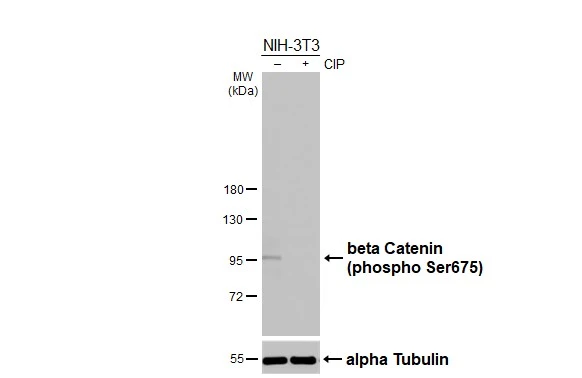 Untreated (–) and treated (+) NIH-3T3 whole cell extract (30 μg) were separated by 7.5% SDS-PAGE, and the membranes were blotted with beta Catenin (phospho Ser675) antibody (GTX132611) diluted at 1:500. The HRP-conjugated anti-rabbit IgG antibody (GTX213110-01) was used to detect the primary antibody
