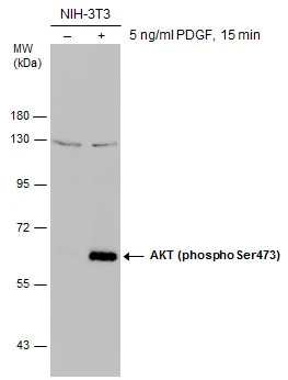 Untreated (–) and treated (+) NIH-3T3 whole cell extracts (30 μg) were separated by 7.5% SDS-PAGE, and the membrane was blotted with AKT (phospho Ser473) antibody (GTX132615) diluted at 1:1000.
