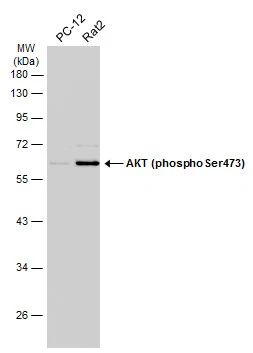 Various whole cell extracts (30 μg) were separated by 10% SDS-PAGE, and the membrane was blotted with AKT (phospho Ser473) antibody (GTX132615) diluted at 1:500. The HRP-conjugated anti-rabbit IgG antibody (GTX213110-01) was used to detect the primary antibody.