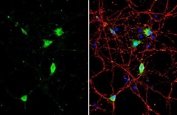 Anti-BDNF antibody (GTX132621) | GeneTex