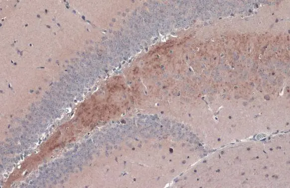 Anti-BDNF antibody (GTX132621) | GeneTex
