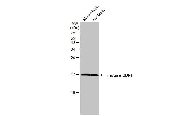 Anti-Influenza A virus PA protein antibody (GTX118991) | GeneTex