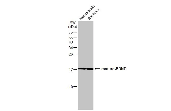Various tissue extracts (50 μg) were separated by 15% SDS-PAGE, and the membrane was blotted with BDNF antibody (GTX132621) diluted at 1:500. The HRP-conjugated anti-rabbit IgG antibody (GTX213110-01) was used to detect the primary antibody.