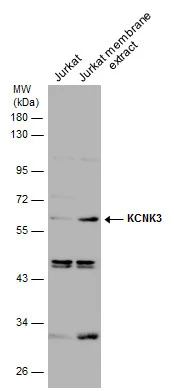 Jurkate whole cell and membrane extracts (30 μg) were separated by 10% SDS-PAGE, and the membrane was blotted with KCNK3 antibody (GTX132622) diluted at 1:1000.