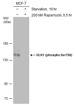 Untreated (–) and treated (+) MCF7 whole cell extracts (60 μg) were separated by 7.5% SDS-PAGE, and the membrane was blotted with ULK1 (phospho Ser758) antibody (GTX132654) diluted at 1:500.