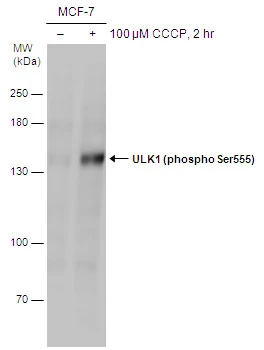 Untreated (–) and treated (+) MCF-7 whole cell extracts (60 μg) were separated by 7.5% SDS-PAGE, and the membrane was blotted with ULK1 (phospho Ser555) antibody (GTX132660) diluted at 1:1000.