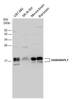 Various whole cell extracts (60 μg) and tissue extracts (15 μg) were separated by 15% SDS-PAGE, and the membrane was blotted with GABARAPL1 antibody (GTX132664) diluted at 1:1000.