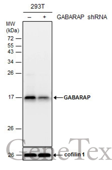 Non-transfected (–) and transfected (+) 293T whole cell extracts (30 μg) were separated by 15% SDS-PAGE, and the membrane was blotted with GABARAP antibody (GTX132665) diluted at 1:3000.