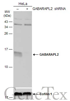 Non-transfected (–) and transfected (+) HeLa whole cell extracts (50 μg) were separated by 15% SDS-PAGE, and the membrane was blotted with GABARAPL2 antibody (GTX132666) diluted at 1:500. The HRP-conjugated anti-rabbit IgG antibody (GTX213110-01) was used to detect the primary antibody, and the signal was developed with Trident ECL plus-Enhanced.
