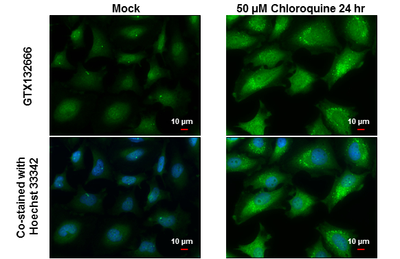 GABARAPL2 antibody detects GABARAPL2 protein at autophagosome? by immunofluorescent analysis. Sample: Mock and treated HeLa cells were fixed in 4% paraformaldehyde at RT for 15 min. Green: GABARAPL2 stained by GABARAPL2 antibody (GTX132666) diluted at 1:500. Blue: Hoechst 33342 staining. Scale bar= 10 μm.