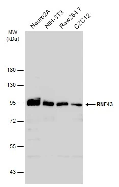 Various whole cell extracts (30 μg) were separated by 7.5% SDS-PAGE, and the membrane was blotted with RNF43 antibody (GTX132671) diluted at 1:1000. The HRP-conjugated anti-rabbit IgG antibody (GTX213110-01) was used to detect the primary antibody.