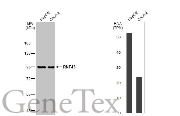 Various whole cell extracts (30 μg) were separated by 7.5% SDS-PAGE, and the membrane was blotted with RNF43 antibody (GTX132671) diluted at 1:2000. The HRP-conjugated anti-rabbit IgG antibody (GTX213110-01) was used to detect the primary antibody. Corresponding RNA expression data for the same cell lines are based on Human Protein Atlas program.