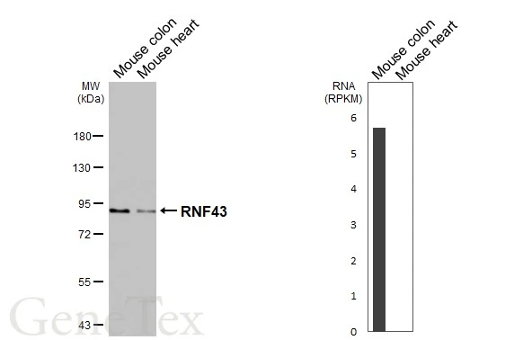Various tissue extracts (50 μg) were separated by 7.5% SDS-PAGE, and the membrane was blotted with RNF43 antibody (GTX132671) diluted at 1:1000. The HRP-conjugated anti-rabbit IgG antibody (GTX213110-01) was used to detect the primary antibody, and the signal was developed with Trident femto Western HRP Substrate. Corresponding RNA expression data are based on NCBI database.