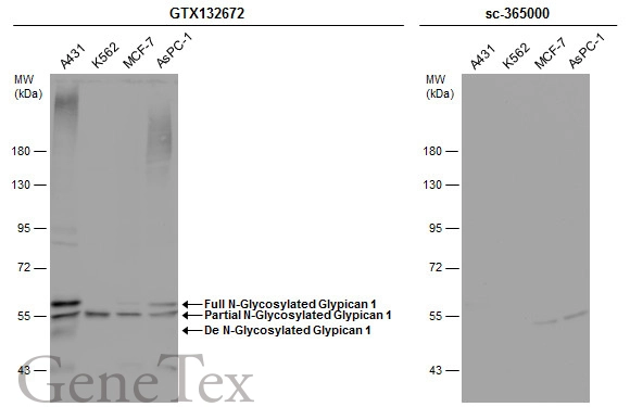Various whole cell extracts (30 μg) were separated by 7.5% SDS-PAGE, and the membranes were blotted with Glypican 1 antibody (GTX132672) diluted at 1:500 and competitor's antibody (sc-365000) diluted at 1:500. The HRP-conjugated anti-rabbit IgG antibody (GTX213110-01) was used to detect the primary antibody.