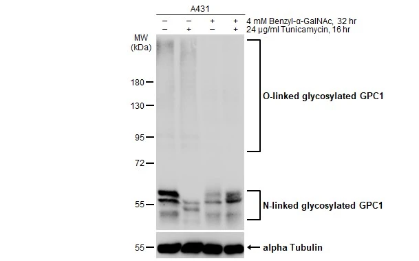 Untreated (–) and treated (+) A431 whole cell extracts (30 μg) were separated by 7.5% SDS-PAGE, and the membrane was blotted with Glypican 1 antibody (GTX132672) diluted at 1:1000. The HRP-conjugated anti-rabbit IgG antibody (GTX213110-01) was used to detect the primary antibody.